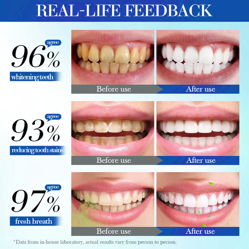 💥Hot Listing 🔥Hydroxyapatite Toothpaste 7.5% for Enamel Repair & Teeth Whitening Refreshing Flavor Fluorid