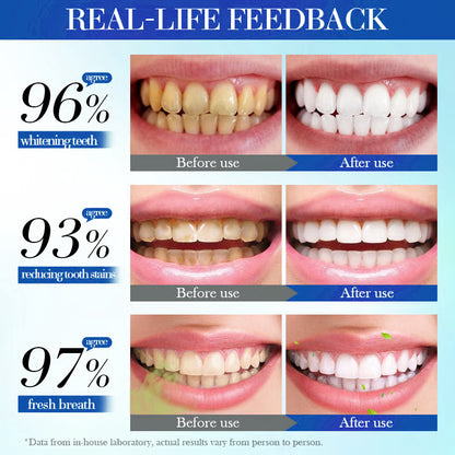 💥Hot Listing 🔥Hydroxyapatite Toothpaste 7.5% for Enamel Repair & Teeth Whitening Refreshing Flavor Fluorid