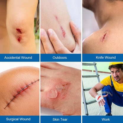 🔥Limited-Time Deal 49% OFF - Emergency Butterfly Bandaids for Wound Closure