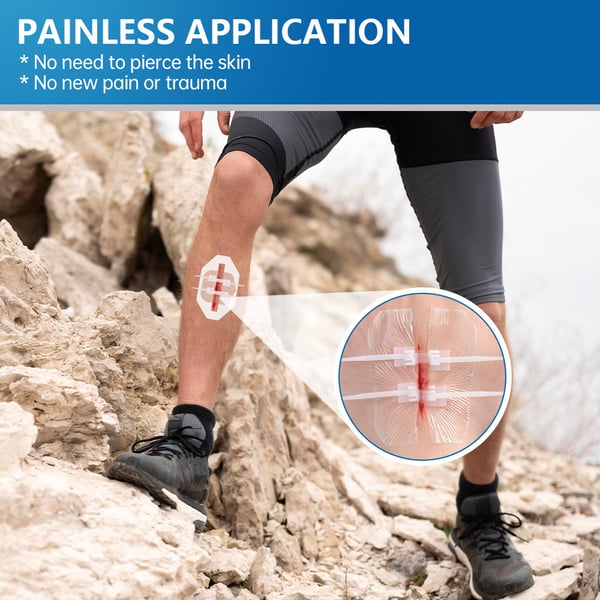 🔥Limited-Time Deal 49% OFF - Emergency Butterfly Bandaids for Wound Closure