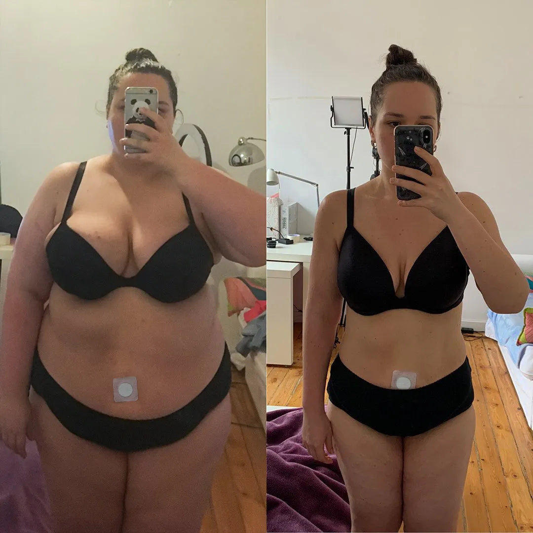 Natravor™ GLP-1 Patches – Fast Results for a Slimmer, Healthier You