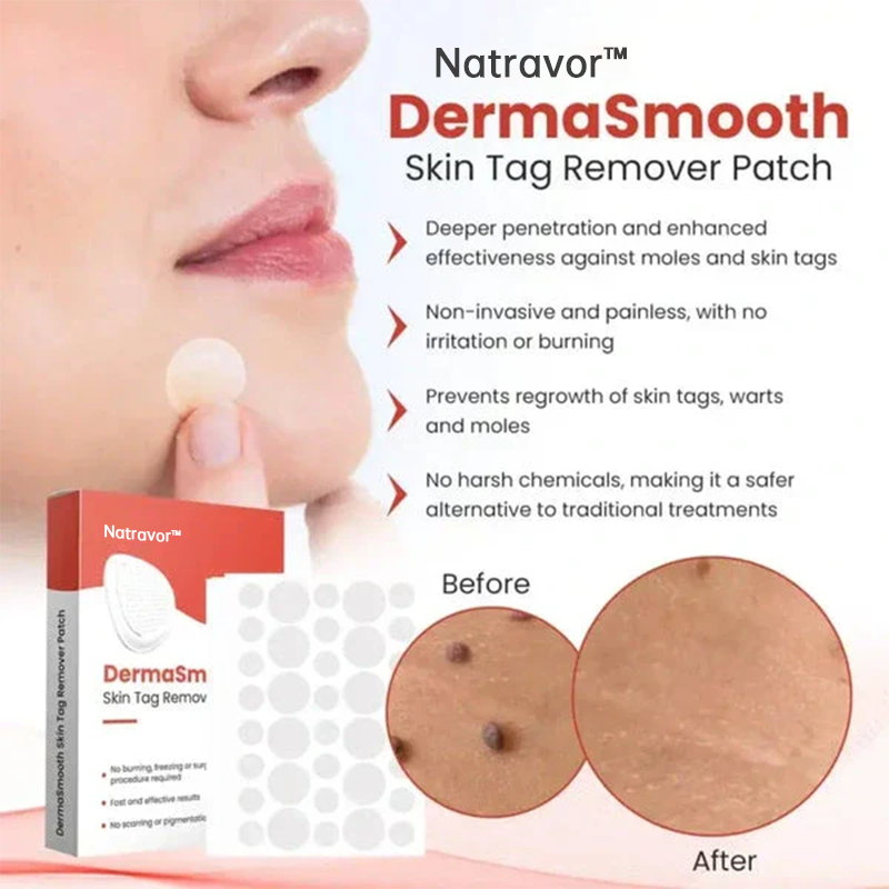 Natravor™ Skin Tag Removal Patch - 144 Patches