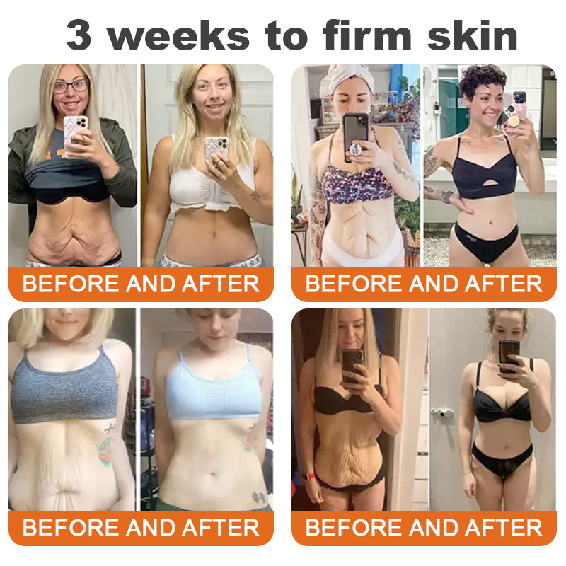 Made and Shipped from USA✨SWIFLOA® Botox Bee Venom Firming Serum Stick💄