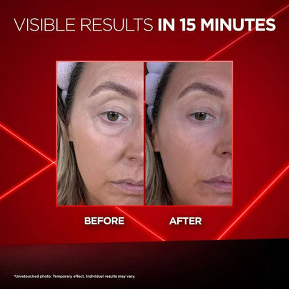 🎁Today's Special🔥Eye Bag Instant Eraser