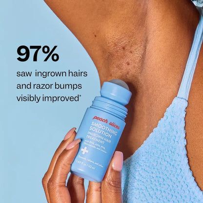 Smoothing Solution Ingrown Hair Treatment: Glide Your Way to Silky-Smooth, Bump-Free Skin