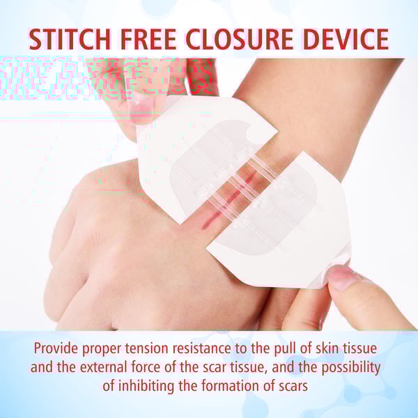 🔥Limited-Time Deal 49% OFF - Emergency Butterfly Bandaids for Wound Closure