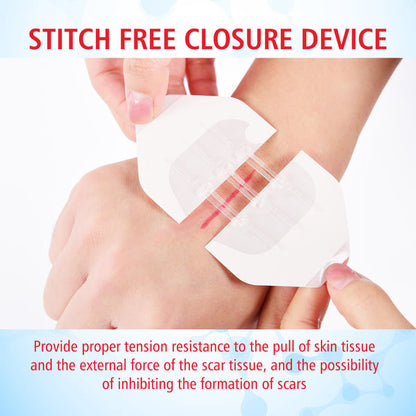 🔥Limited-Time Deal 49% OFF - Emergency Butterfly Bandaids for Wound Closure